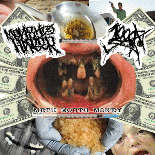 Money Hater : Meth Mouth Money